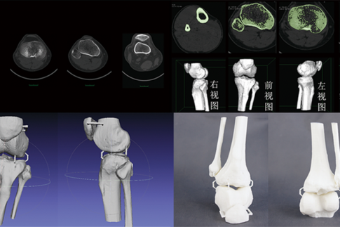 CTάؽģģ;ϸģ޸ģ3Dӡٳ