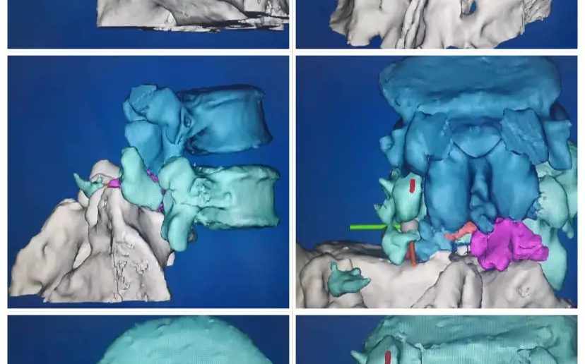 3DӡģԽֱۡ˽⻼ߵĲƶӦƻ߽Ƽƻ.webp