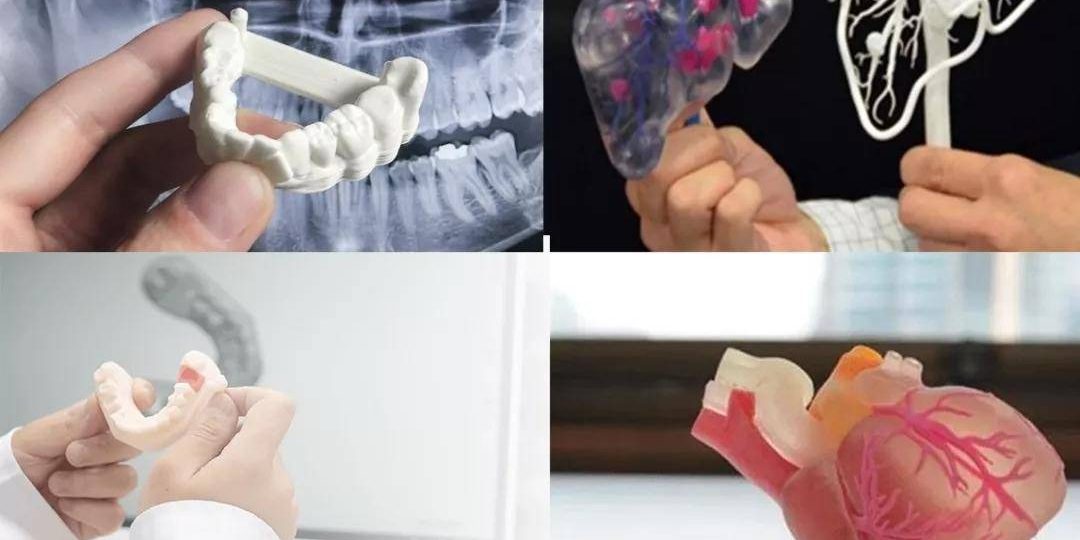 CTάؽҽѧ3DӡڹǿеľӦ