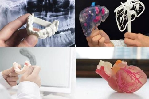 CTάؽҽѧ3DӡڹǿеľӦ